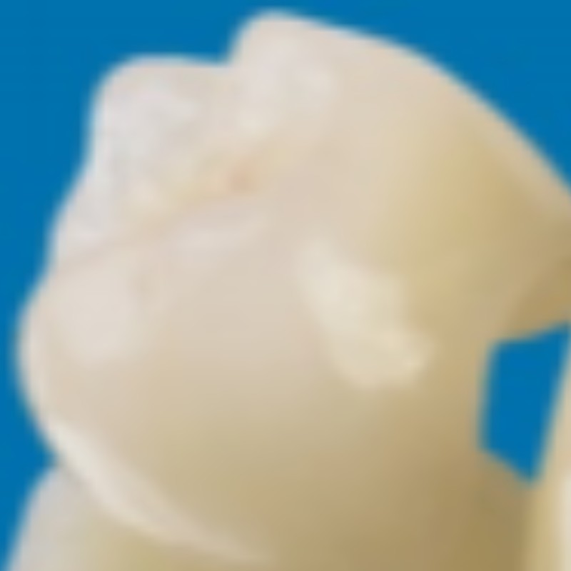 Todo-dientes de cerámica